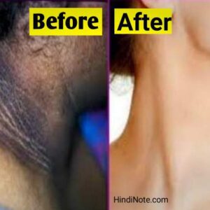 How to Remove Neck Scum in Hindi : गर्दन का मैल कैसे हटाए जानिए
